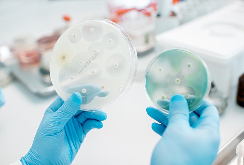 Looking on the effect of antibiotics on bacteria in Petri dishes at the laboratory. Making bacteriological tests
